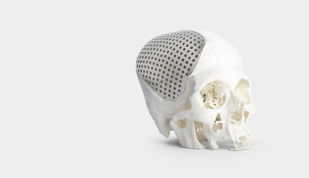 Healthcare 3D printing